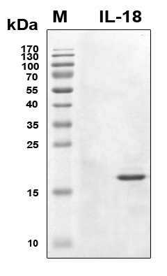 IL18 Protein - SDS-PAGE under reducing conditions and visualized by Coomassie blue staining