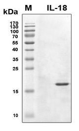 IL18 Protein - SDS-PAGE under reducing conditions and visualized by Coomassie blue staining