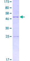 IL18 Protein - 12.5% SDS-PAGE of human IL18 stained with Coomassie Blue
