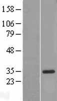 IL18BP Protein - Western validation with an anti-DDK antibody * L: Control HEK293 lysate R: Over-expression lysate