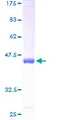 IL18BP Protein - 12.5% SDS-PAGE of human IL18BP stained with Coomassie Blue