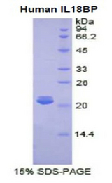 IL18BP Protein