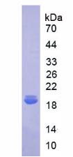 IL18BP Protein - Recombinant Interleukin 18 Binding Protein By SDS-PAGE