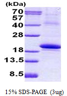 IL18BP Protein