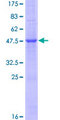 IL19 Protein - 12.5% SDS-PAGE of human IL19 stained with Coomassie Blue