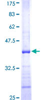 IL19 Protein - 12.5% SDS-PAGE Stained with Coomassie Blue.