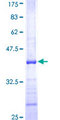 IL19 Protein - 12.5% SDS-PAGE Stained with Coomassie Blue.