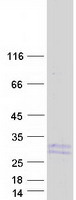 IL19 Protein - Purified recombinant protein IL19 was analyzed by SDS-PAGE gel and Coomassie Blue Staining