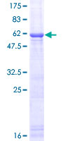 IL1A / IL-1 Alpha Protein - 12.5% SDS-PAGE of human IL1A stained with Coomassie Blue