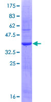 IL1A / IL-1 Alpha Protein - 12.5% SDS-PAGE Stained with Coomassie Blue.