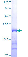 IL1F9 Protein - 12.5% SDS-PAGE Stained with Coomassie Blue.