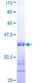 IL1F9 Protein - 12.5% SDS-PAGE Stained with Coomassie Blue.