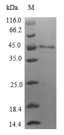 IL1F9 Protein - (Tris-Glycine gel) Discontinuous SDS-PAGE (reduced) with 5% enrichment gel and 15% separation gel.