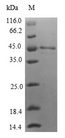 IL1F9 Protein - (Tris-Glycine gel) Discontinuous SDS-PAGE (reduced) with 5% enrichment gel and 15% separation gel.