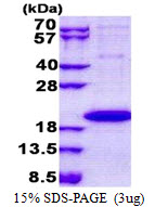 IL1F9 Protein