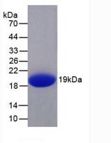 IL1F9 Protein - Active Interleukin 1 Family, Member 9 (IL1F9) by SDS-PAGE