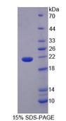 IL1F9 Protein - Recombinant  Interleukin 1 Epsilon By SDS-PAGE