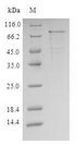 IL1R1 Protein - (Tris-Glycine gel) Discontinuous SDS-PAGE (reduced) with 5% enrichment gel and 15% separation gel.