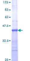IL1R1 Protein - 12.5% SDS-PAGE Stained with Coomassie Blue.