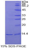 IL1R1 Protein - Recombinant Interleukin 1 Receptor Type I By SDS-PAGE
