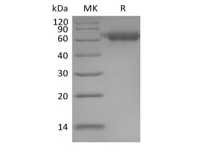 IL1RAP Protein - Recombinant Human IL-1 Receptor Accessory Protein/IL-1RAcP/IL-1R3 (C-6His)