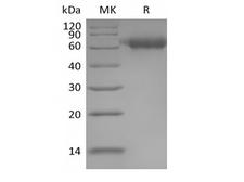 IL1RAP Protein - Recombinant Human IL-1 Receptor Accessory Protein/IL-1RAcP/IL-1R3 (C-6His)