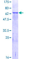 IL1RAP Protein - 12.5% SDS-PAGE of human IL1RAP stained with Coomassie Blue