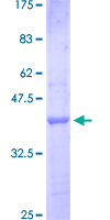 IL1RAPL1 Protein - 12.5% SDS-PAGE Stained with Coomassie Blue.