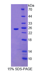 IL1RAPL1 Protein - Recombinant Interleukin 1 Receptor Accessory Protein Like Protein 1 By SDS-PAGE