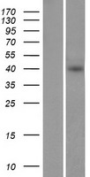 IL1RL1 Protein - Western validation with an anti-DDK antibody * L: Control HEK293 lysate R: Over-expression lysate