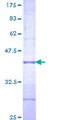 IL1RL2 Protein - 12.5% SDS-PAGE Stained with Coomassie Blue.