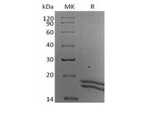IL2 Protein - Recombinant Human Interleukin-2/IL-2 (C-6His-Avi) Biotinylated