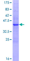 IL2 Protein - 12.5% SDS-PAGE of human IL2 stained with Coomassie Blue