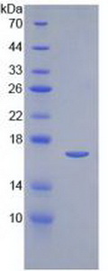 IL2 Protein - Recombinant Interleukin 2 By SDS-PAGE
