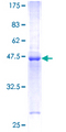 IL20 Protein - 12.5% SDS-PAGE of human IL20 stained with Coomassie Blue