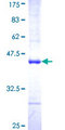 IL20 Protein - 12.5% SDS-PAGE Stained with Coomassie Blue.