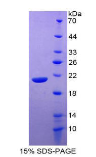 IL20 Protein - Recombinant Interleukin 20 By SDS-PAGE