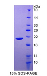 IL20 Protein - Recombinant Interleukin 20 By SDS-PAGE