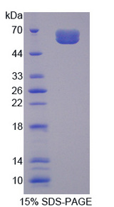 IL20RA Protein - Recombinant Interleukin 20 Receptor Alpha By SDS-PAGE