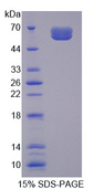 IL20RA Protein - Recombinant Interleukin 20 Receptor Alpha By SDS-PAGE