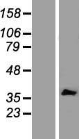 IL20RB Protein - Western validation with an anti-DDK antibody * L: Control HEK293 lysate R: Over-expression lysate