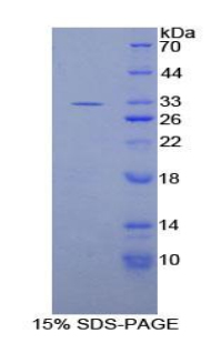 IL20RB Protein - Recombinant Interleukin 20 Receptor Beta By SDS-PAGE