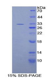 IL20RB Protein - Recombinant Interleukin 20 Receptor Beta By SDS-PAGE