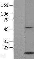 IL21 Protein - Western validation with an anti-DDK antibody * L: Control HEK293 lysate R: Over-expression lysate