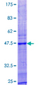 IL21 Protein - 12.5% SDS-PAGE of human IL21 stained with Coomassie Blue