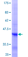 IL21 Protein - 12.5% SDS-PAGE Stained with Coomassie Blue.