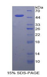 IL21 Protein - Recombinant Interleukin 21 By SDS-PAGE
