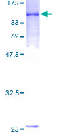 IL21 Receptor Protein - 12.5% SDS-PAGE of human IL21R stained with Coomassie Blue