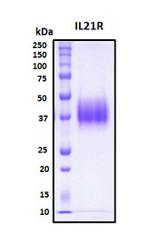 IL21 Receptor Protein - SDS-PAGE under reducing conditions and visualized by Coomassie blue staining