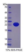 IL21 Receptor Protein - Recombinant  Interleukin 21 Receptor By SDS-PAGE